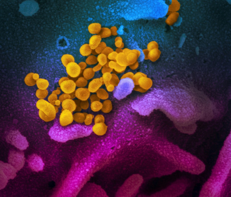 A microscopic image of SARS-CoV-2 in yellow