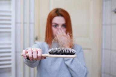 Hair loss Hair loss