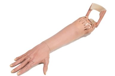 Unlimited Tomorrow offers affordable prosthetic limbs 