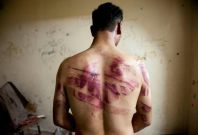 Syrian man tortured Syrian man tortured
