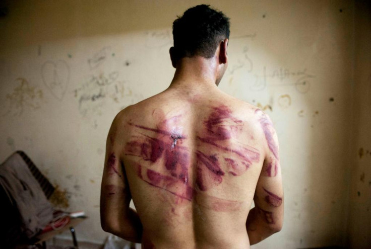 Syrian man tortured