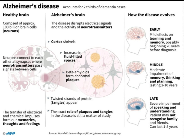 Alzheimer-Erkrankung