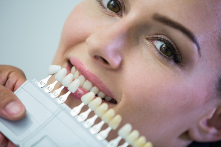 What Is The Cost For Teeth Veneers