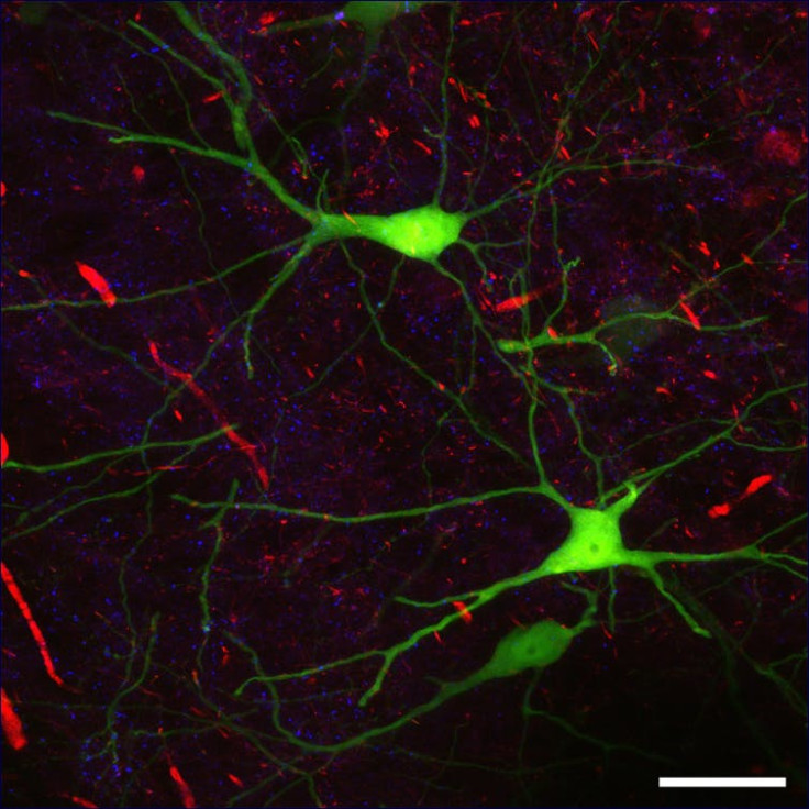  Different types of synapses in a mouse brain slice.