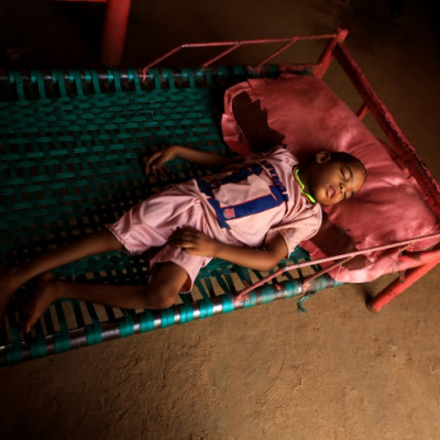 Talab, the youngest child of Awadya Ahmed, lies on a bed in the village of Banat in River Nile state, north of the Sudanese capital Khartoum. She says Talab was born after mining residues spread in the area