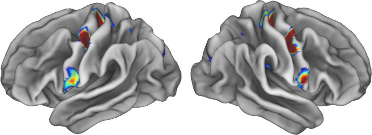 Brain activity