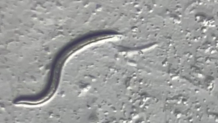 A worm viewed by medical experts
