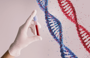 Le Royaume-Uni devient le premier pays à autoriser la thérapie génique pour le traitement de l’anémie falciforme