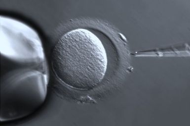 In-vitro fertilization