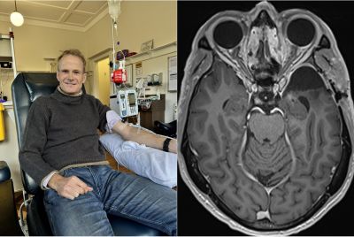 Professor Richard Scolyer