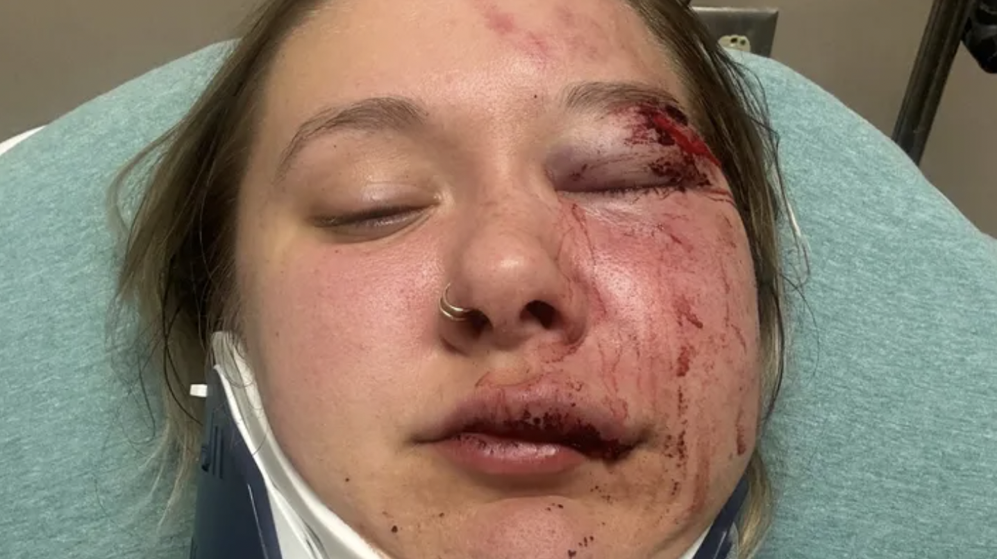 Michigan Woman Brutally Beaten After Uber Drops Her Off At Wrong Spot—Attacker Still On The Loose