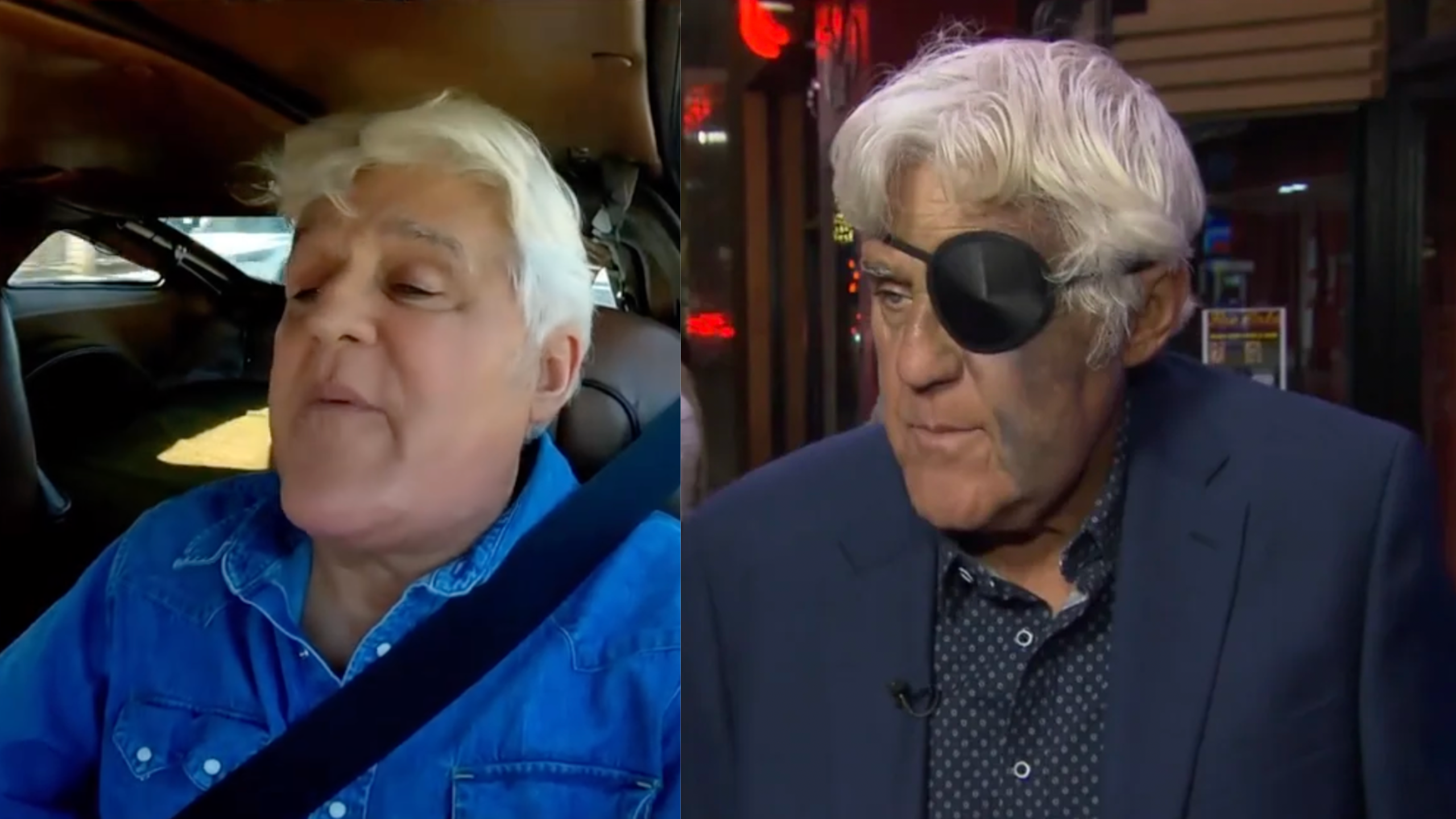 What Happened To Jay Leno’s Face: Talk Show Host Says Black And Blue Bruises Aren’t ‘A Big Deal’