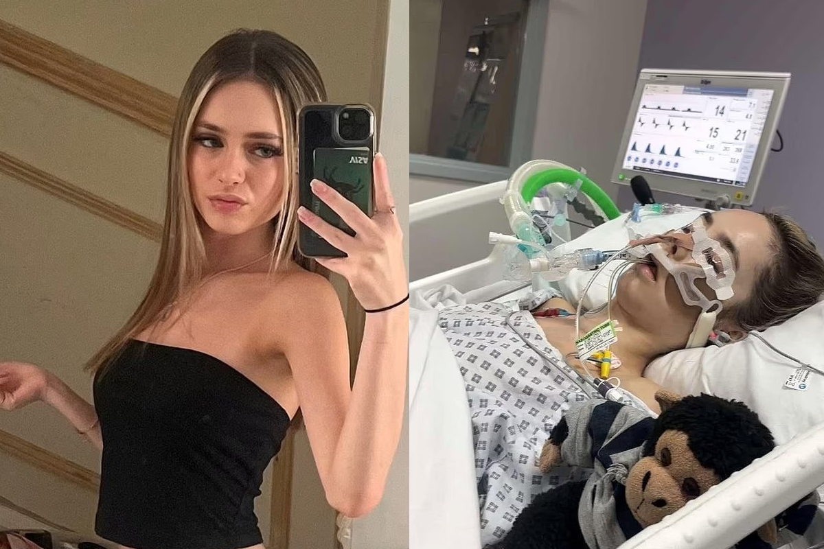 Teen Almost Dies From Meningitis After Sharing A Vape And Drinks During Night Out: Symptoms To Look Out For