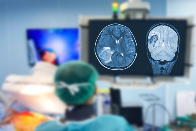 brain scan