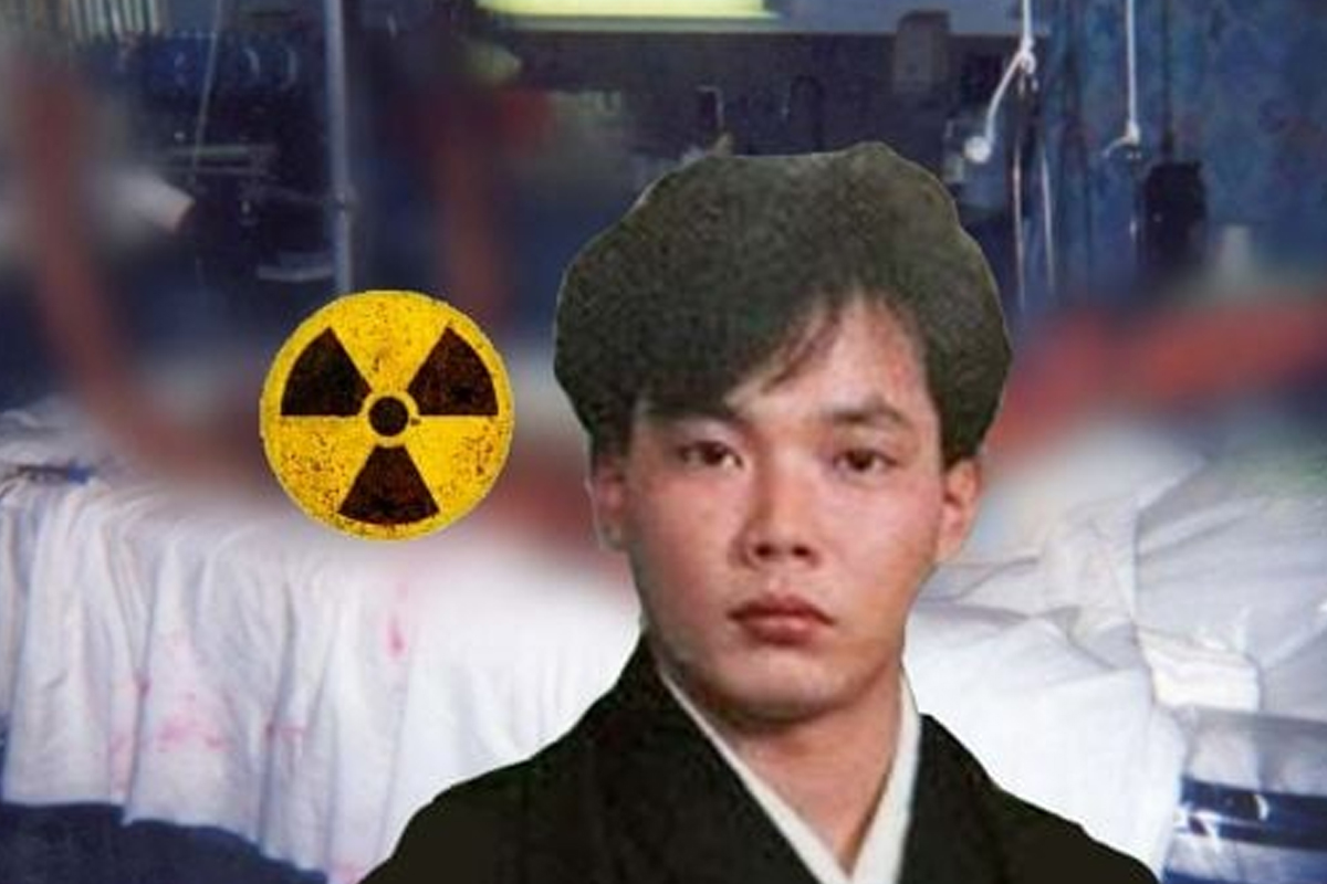 Who Is Hisashi Ouchi: The Man Who Endured the Most Horrific Radiation Death in History