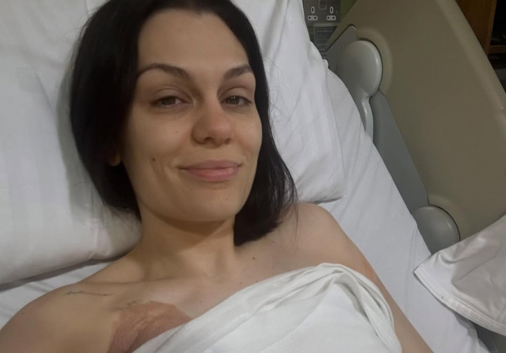 Jessie J