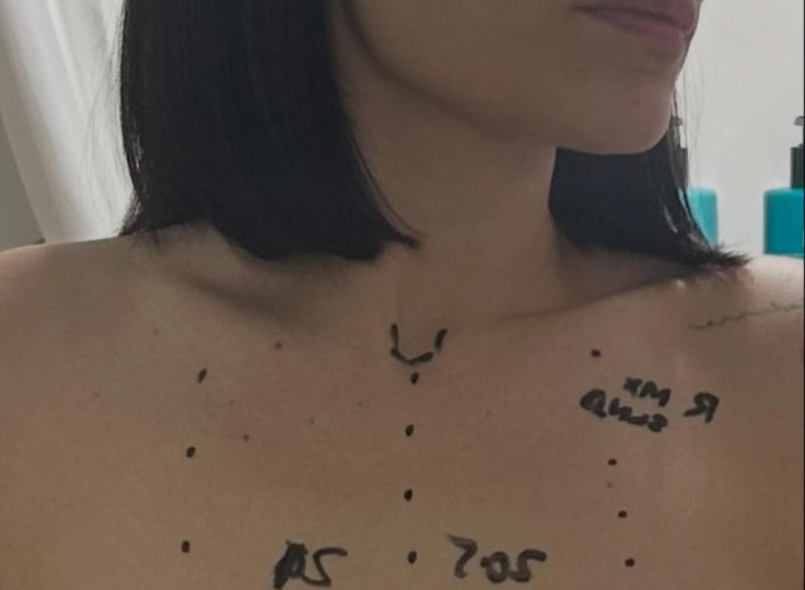 Jessie J shared updates regarding her cancer treatment