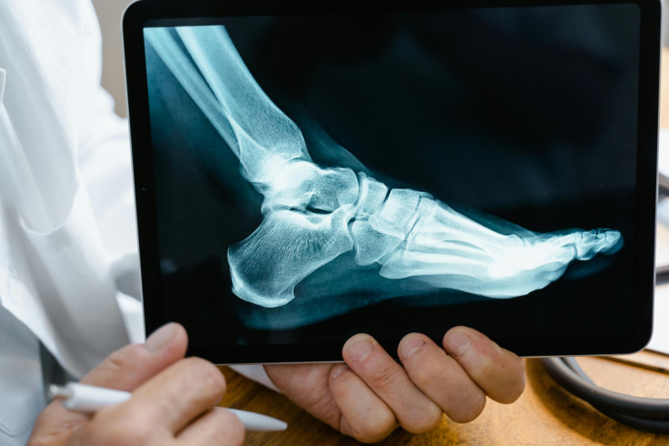 A person holding an xray result