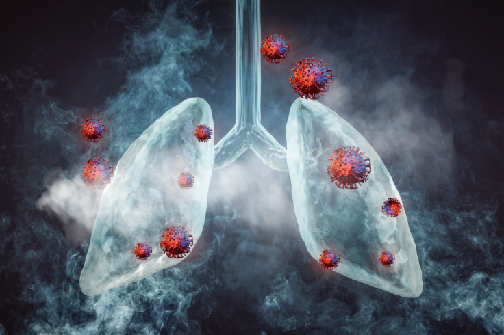 Legionnaires' disease