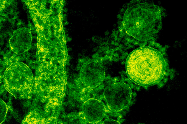 UK Chickenpox Alert