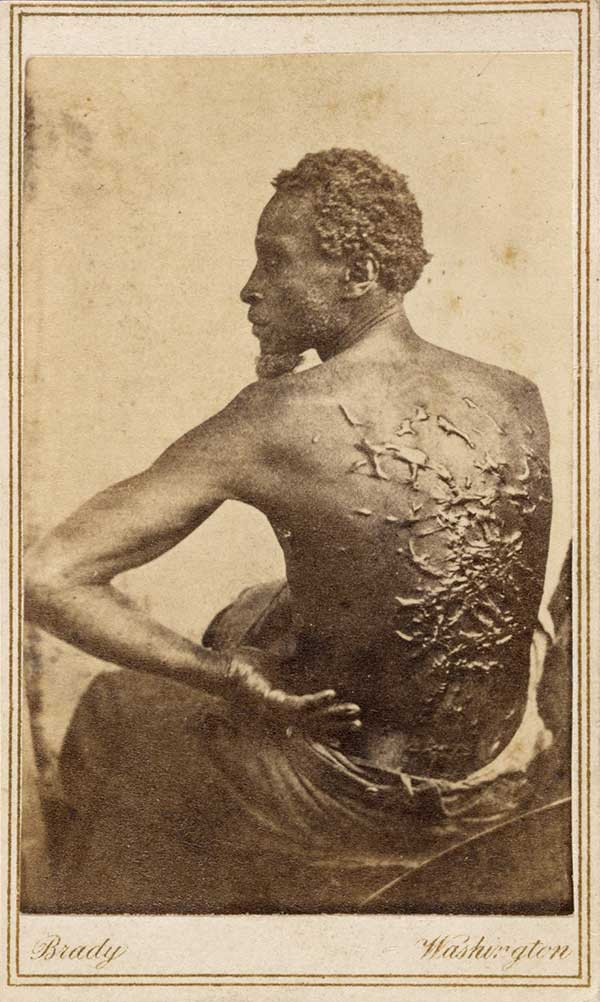 Scourged Back