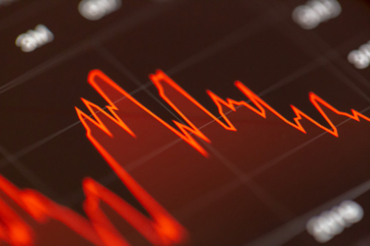 Stock Market Dip
