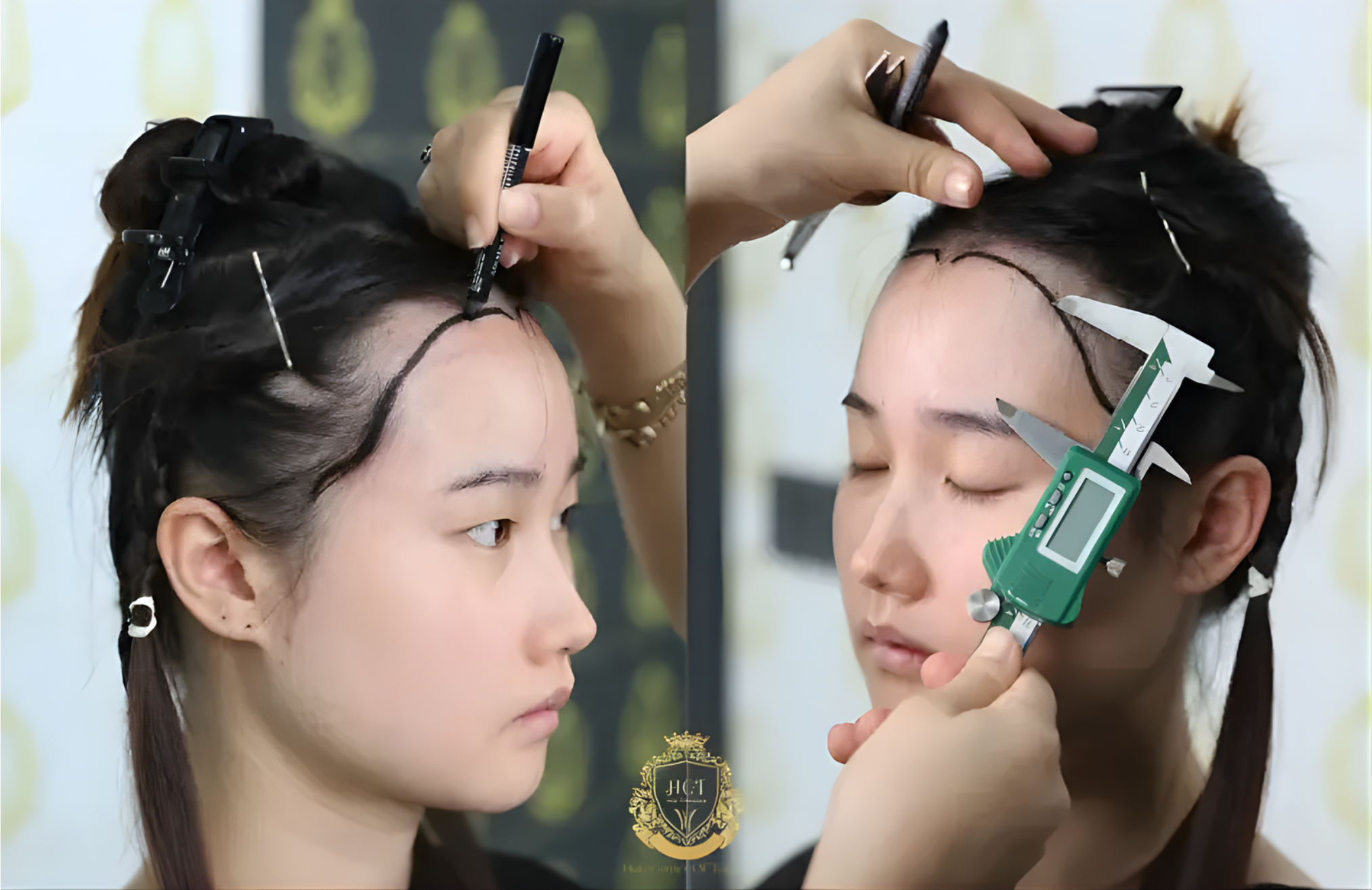 Clinic exterior and hair restoration imagery in Turkey