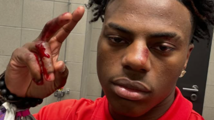 iShowSpeed Rizzbot Scandal Explained: Why Streamer Faces $1M Lawsuit Ahead