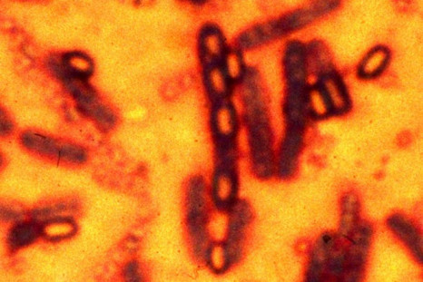 A microscopic picture of spores and vegetative cells of Bacillus anthracis which causes the disease anthrax is pictured in this undated file photograph.
