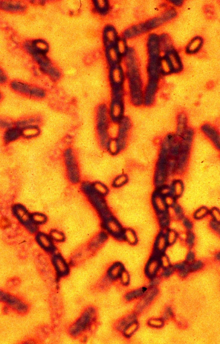 A microscopic picture of spores and vegetative cells of Bacillus anthracis which causes the disease anthrax is pictured in this undated file photograph.