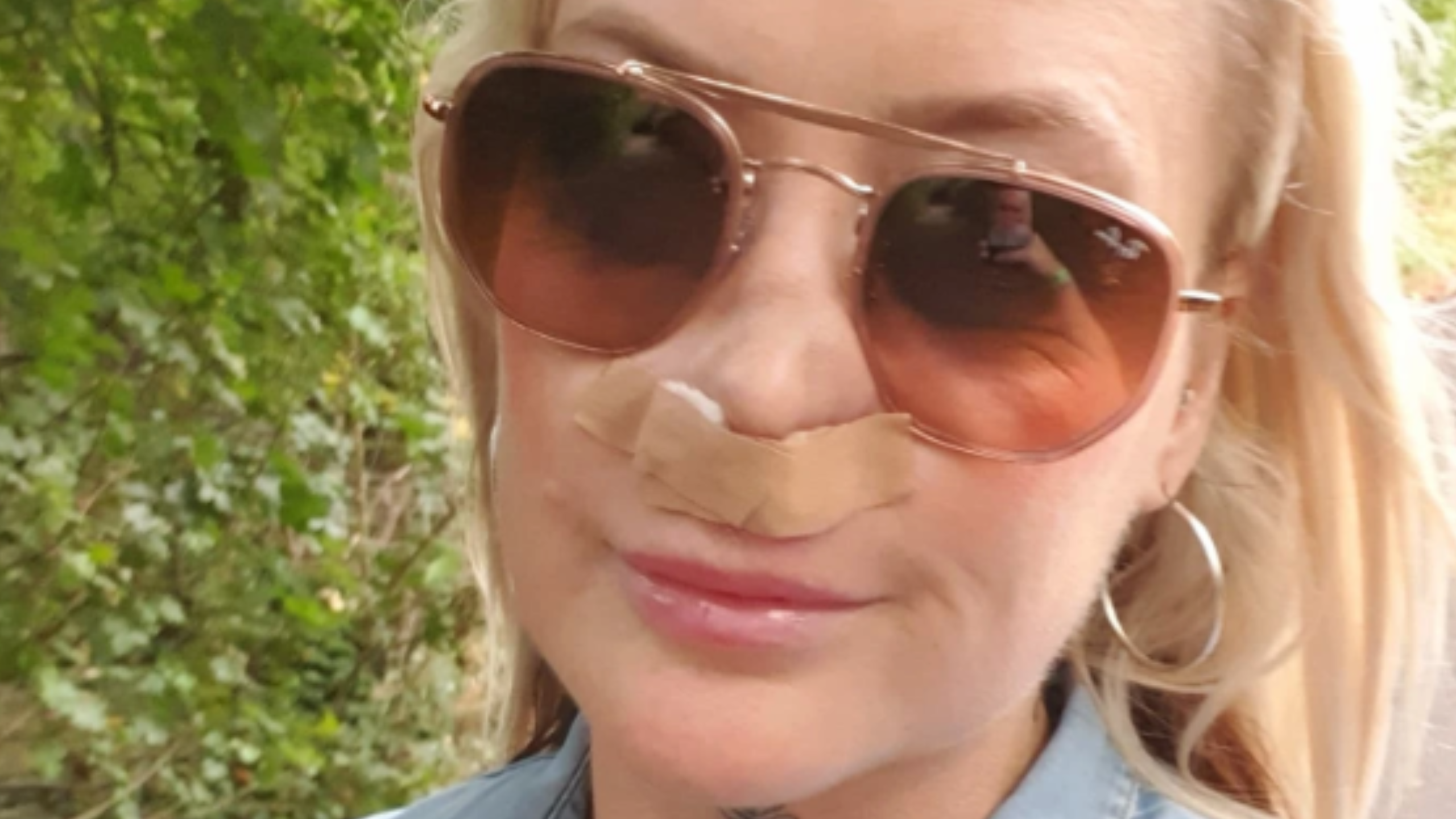 British Woman's Face Melted After 'Turkey Teeth' Procedure — Here's What Happened To Leanne Abeyance