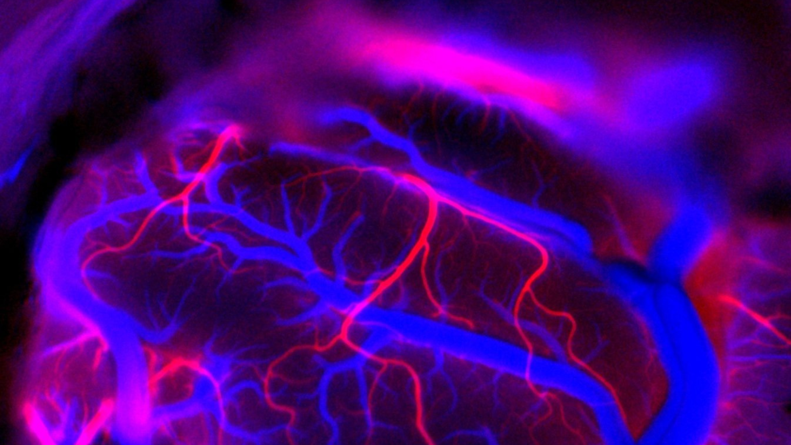 ibtimes.co.uk - Giuliano de Leon - Musk Prepares Neuralink Mass Production, Promises Fully Automated Surgeries