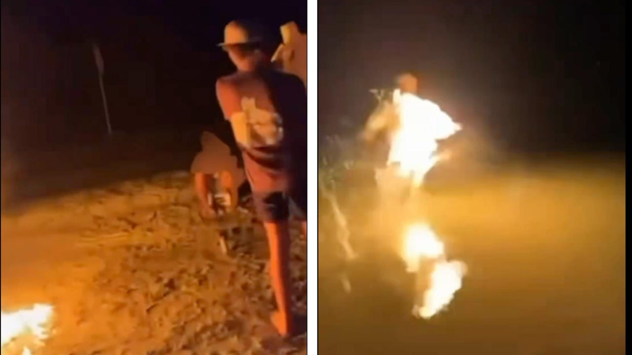 'Irreversible Harm': Florida Teen Charged After Friend Is Set on Fire ...