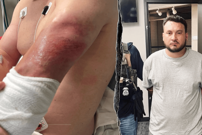 ICE Agent Dragged by Illegal Alien