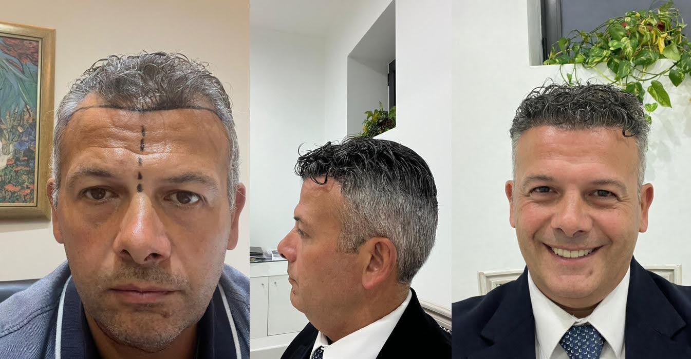 Why Confidence Is Becoming the New Currency in Aesthetic Medicine