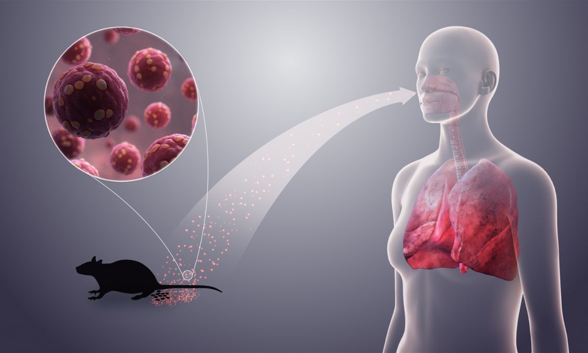 Why the CDC Activates Level 3 as WHO Tracks Hantavirus Across 11 Countries