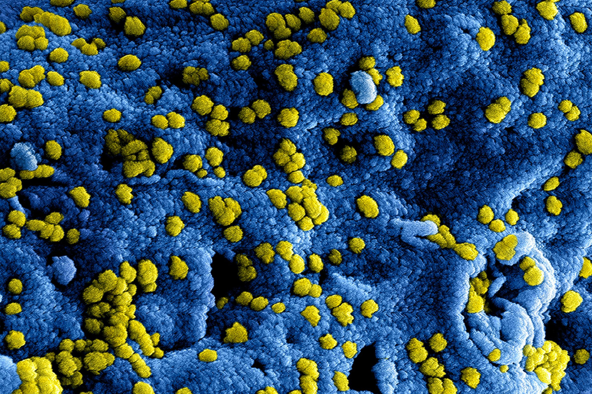 Trump Sparks Outrage by Calling Hantavirus Concerns 'False Pandemics' and Rejecting Future Lockdowns
