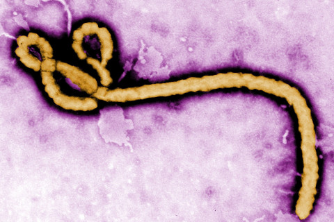 The Ebola virus virion