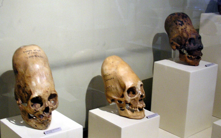 Paracas Skulls