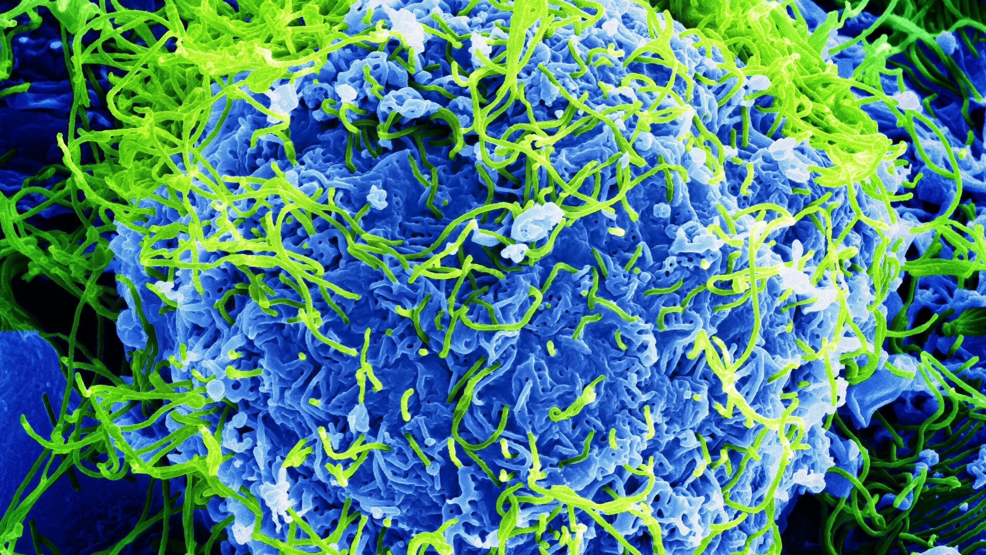 How Far Has Ebola Spread? Italy And Brazil Probe Suspected Cases