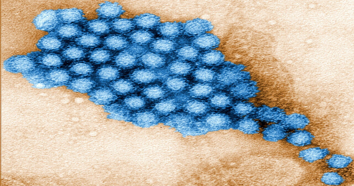 Is a 'Vomiting Virus' Sweeping the US? New Data Reveals Sharp Rise in Norovirus Cases Nationwide
