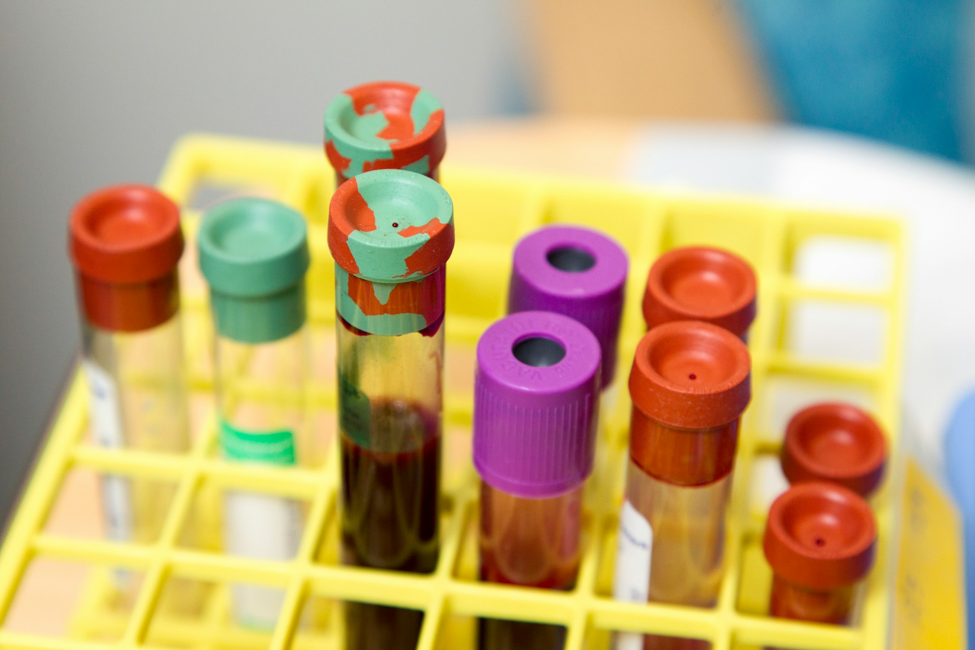 Vials Found in Large Case at Detroit Airport: 2 Researchers Accused of Smuggling Mpox, Chickenpox, DNA Into US