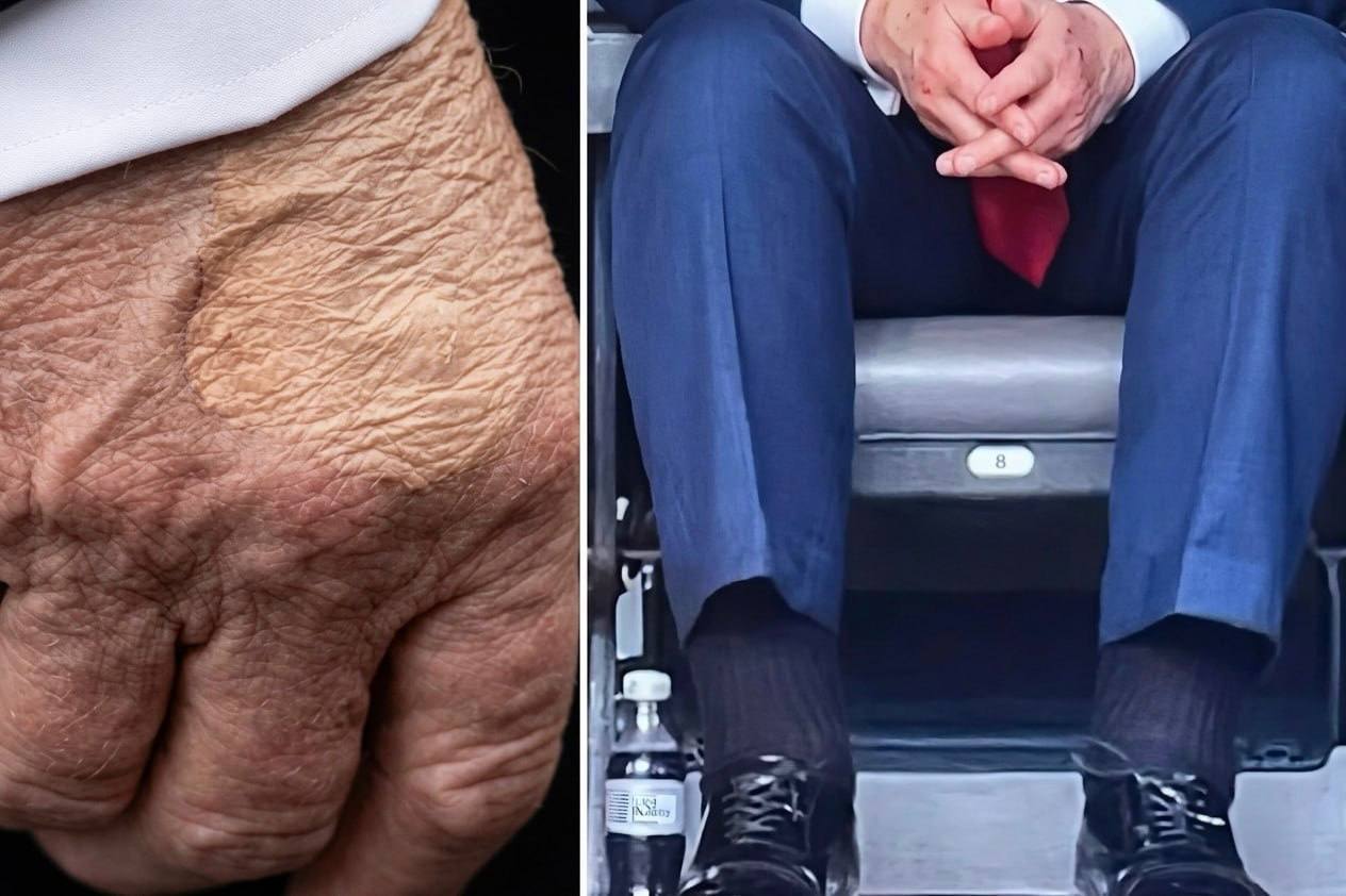 Trump Was Assessed by 22 Specialists for His Checkup and the White House Refuses to Say Why He Neede...
