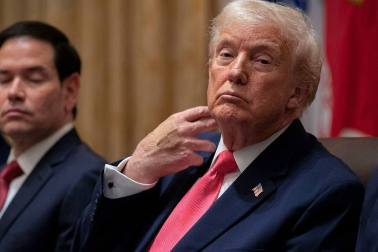 "Trump's Bandaged Hand Sparks Health Speculation"