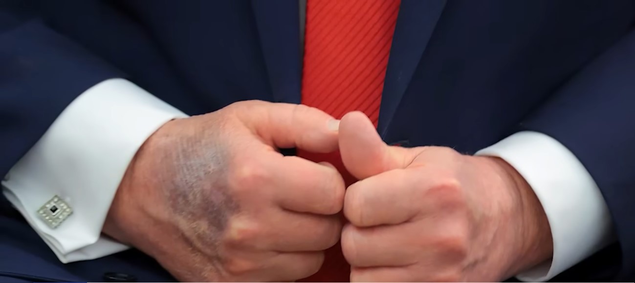 Trump Health Drama Exposed: How the White House Is Allegedly Controlling the Medical Story Tightly