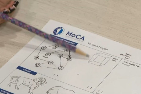 MoCA