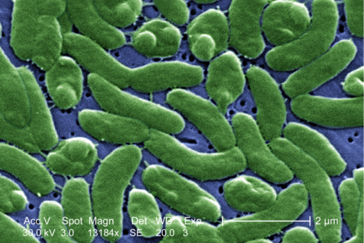 Flesh-Eating Bacteria With 20% Mortality Rate Spreads In US Waterways After Trump Admin Slashed CDC Safeguards