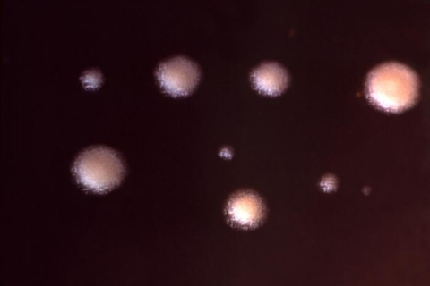 Legionnaires Disease