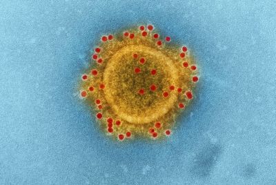 high-resolution-image-of-virus-in-microscope