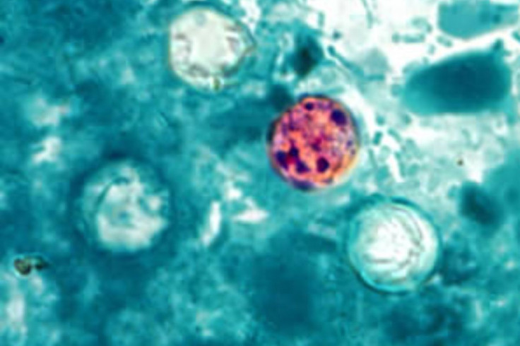 Cyclosporiasis